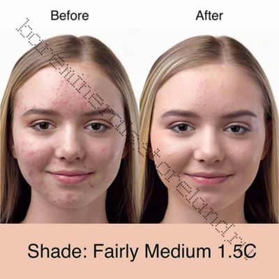 Blemish Rescue bareMinerals fairly medium 1.5c