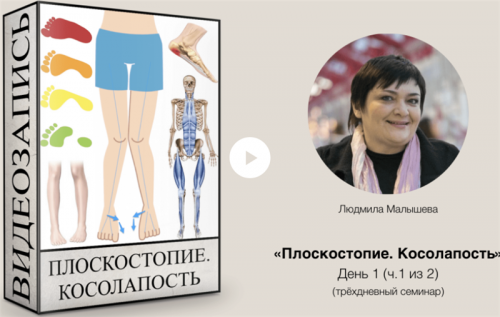 Плоскостопие. Косолапость (Людмила Малышева)