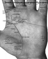 Знаки болезней на руках и периоды развития заболеваний (Вячеслав Ковальчук)