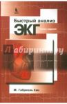 Быстрый анализ ЭКГ / Хан Габриэль М.
