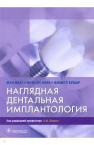 Наглядная дентальная имплантология / Мале Жак, Мора Фрэнсис, Бушар Филипп