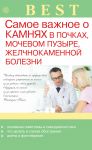 Самое важное о камнях в почках, мочевом пузыре, желчнокаменной болезни