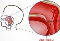 Аденоиды казнить нельзя помиловать (Елена Леднева)