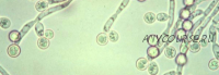 Грибы Candida — вор здоровья
