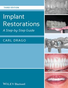 Implant Restorations. A Step-by-Step Guide