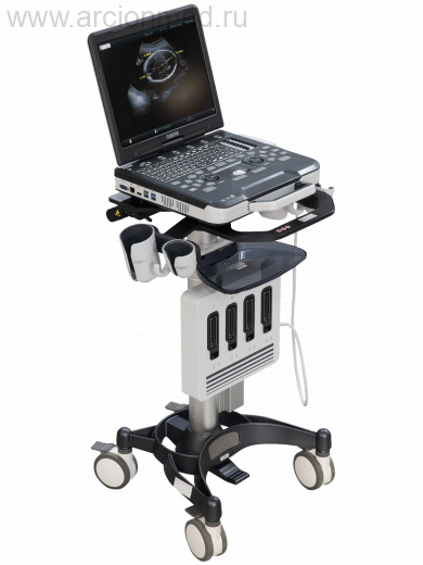 Портативные ультразвуковые системы «УЗИ-Электрон»