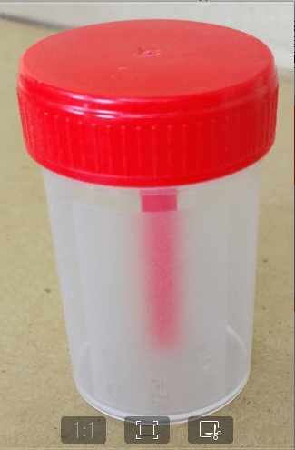 Контейнер для анализов (нестерильный) 0,06 л с ложкой в сборе